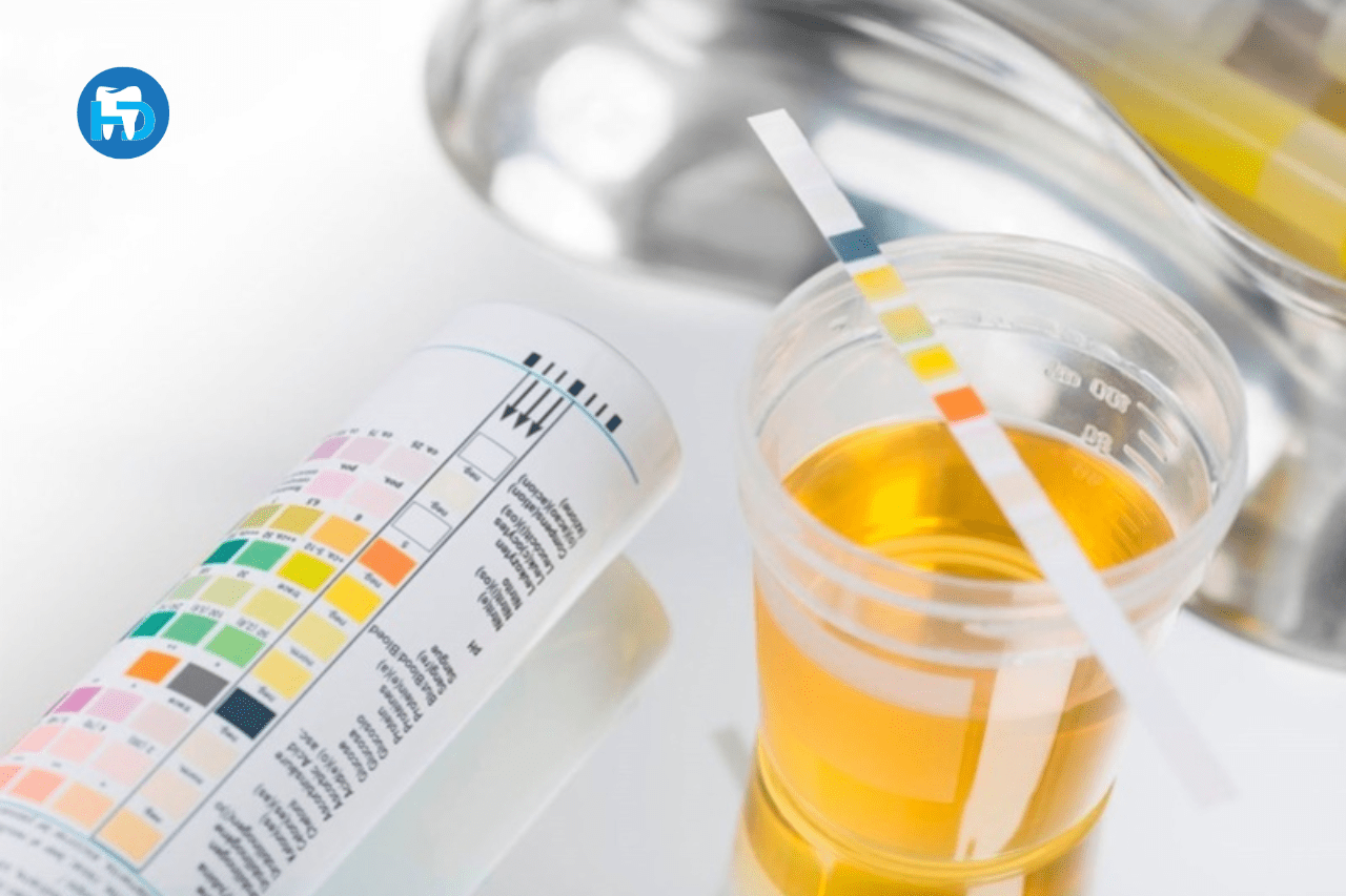 Xét nghiệm tổng phân tích nước tiểu