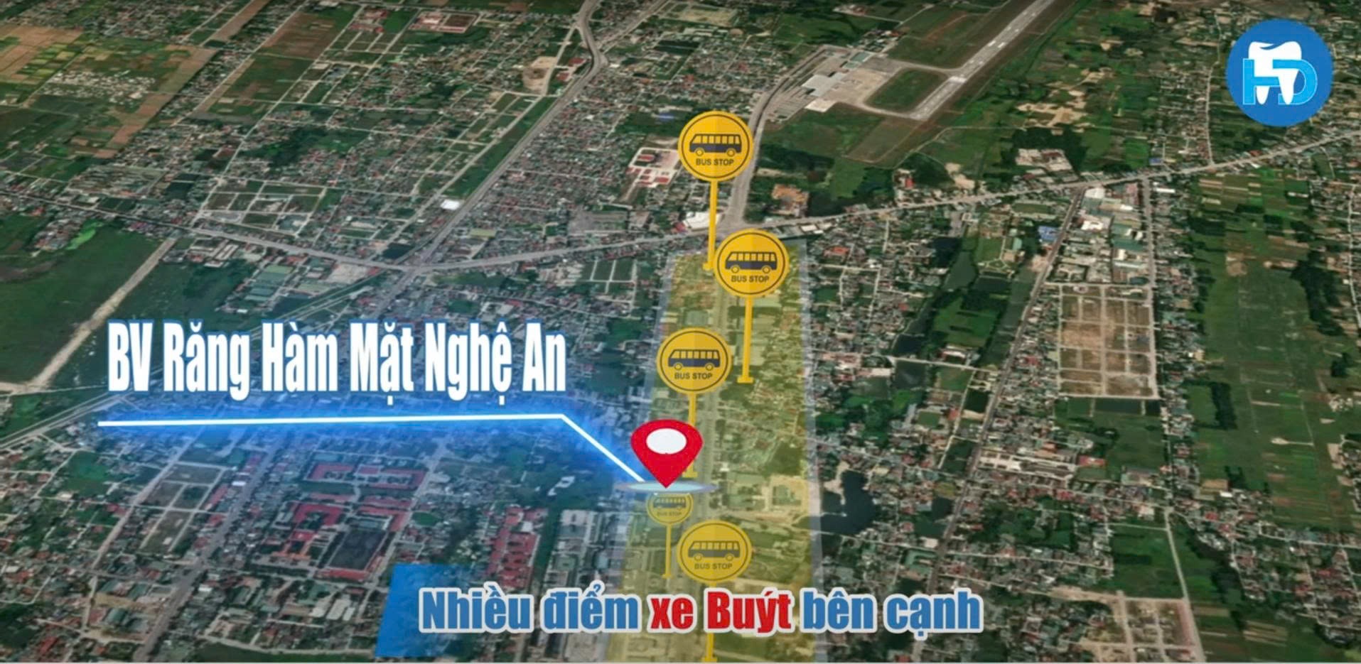 Bệnh viện Răng Hàm Mặt Nghệ An nằm gần các trạm dừng xe buýt lớn